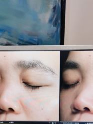 -苑苑vbeauty科技美容SPA