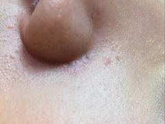 -北京大学第一医院(西城厂桥院区)