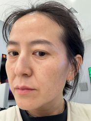 -素美医疗美容·西南眼鼻整形·修复基地