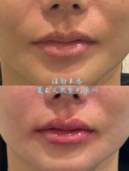 -北京米扬丽格医疗美容·联合丽格鼻整形中心