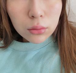 点击看大图 -深圳美莱医疗美容医院