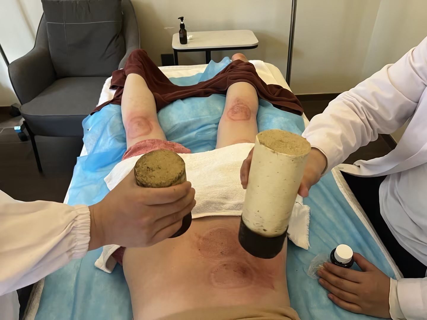 三九天艾灸:冬季养生的秘密武器