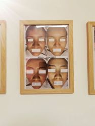 -美肤盾祛痘·问题肌头疗管理中心