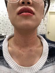-新美荟医美·专注面部美学抗衰