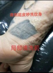 -微刺纹身