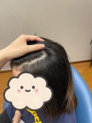 -大麦微针植发全国连锁