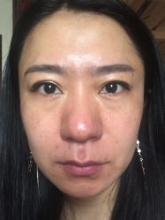 体验前-沈阳亿美医疗美容