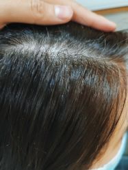 -熙朵美学植发·连锁品牌