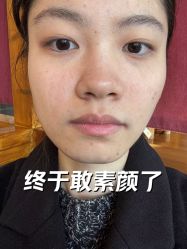 -美丽人生祛斑扁平疣汗管瘤中心