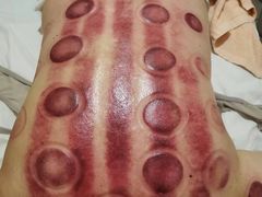 -益友堂盲人推拿正骨穴位按摩工作室