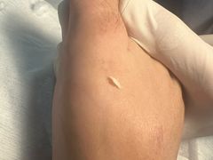 -世龙世家灰指甲鸡眼脚气甲沟炎跖疣护理(通州店)