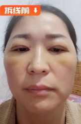 -素美医疗美容·西南眼鼻整形·修复基地