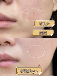 -蕾特恩专业祛痘·皮肤管理