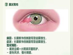 -黑马眼科·近视手术