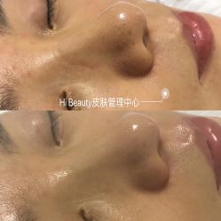 点击看大图 -Hi Beauty Skin 科技美肤中心