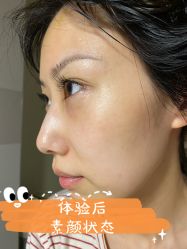 点击看大图 体验后-坤如玛丽·医疗美容中心