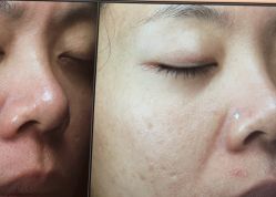 -苑苑vbeauty科技美容SPA