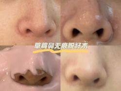 -痘院长·祛痘·皮肤管理