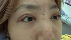 -伊美尔医疗美容医院