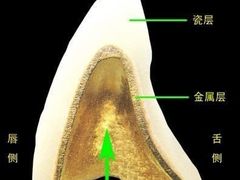 -团圆口腔·种植中心(锦江院区)