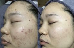 点击看大图 -智丽佳人祛斑祛痘美容美体