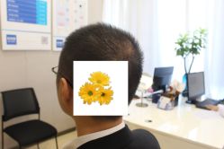 -大麦微针植发丨全国连锁