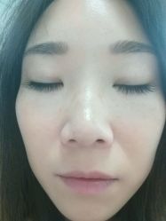 点击看大图 -YooMee优美智能科技美肤机构
