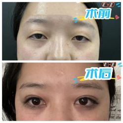 -素美医疗美容·西南眼鼻整形·修复基地