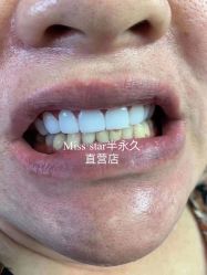 -MISS STAR·半永久纹眉·发际线·美瞳线