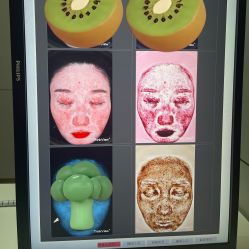 -深圳米兰柏羽医疗美容医院