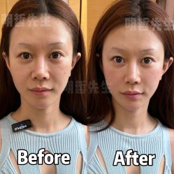 -颜和骨正&明星徒手小颜整骨