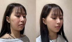 -上海伊莱美医疗美容医院