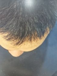 -雍禾植发全国连锁