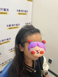 -大麦微针植发全国连锁