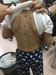 -童安堂小儿推拿