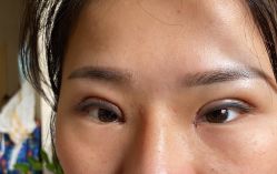体验后-天津伊美尔医疗整形美容专科医院