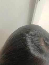 -熙朵美学植发·连锁品牌