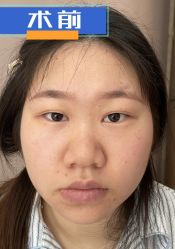 -素美医疗美容·西南眼鼻整形·修复基地