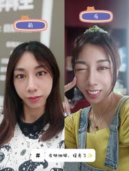 -广州健丽·去眼袋医疗美容机构