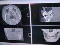 -土豆口腔(凤凰北总店)