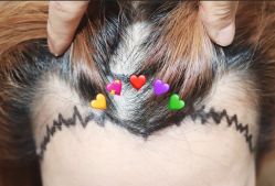 -大麦微针植发全国连锁