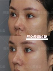 -北京米扬丽格医疗美容·联合丽格鼻整形中心
