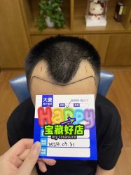 -大麦微针植发全国连锁