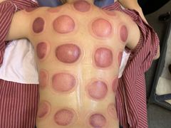 -乾月中医推拿养生馆(城市生活广场店)