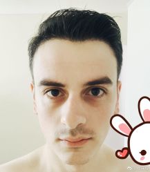 点击看大图 -大麦微针植发丨全国连锁