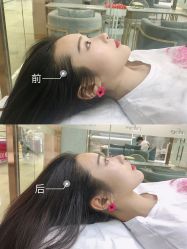 -OnFaer.纹眉半永久无创洗眉