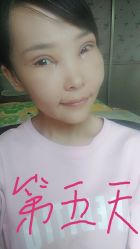 体验后-四川娇点医学美容医院