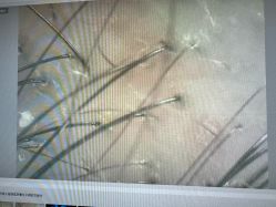 -史云逊养发护发