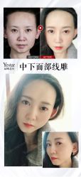 -Yestar艺星医疗美容医院