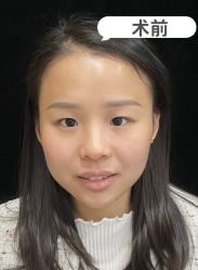 -素美医疗美容·西南眼鼻整形·修复基地
